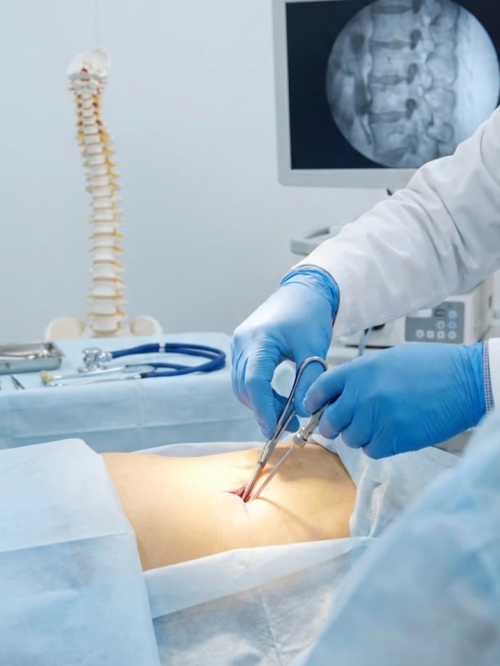 minimal-invasive-surgery-by-dr-abdul-aziz